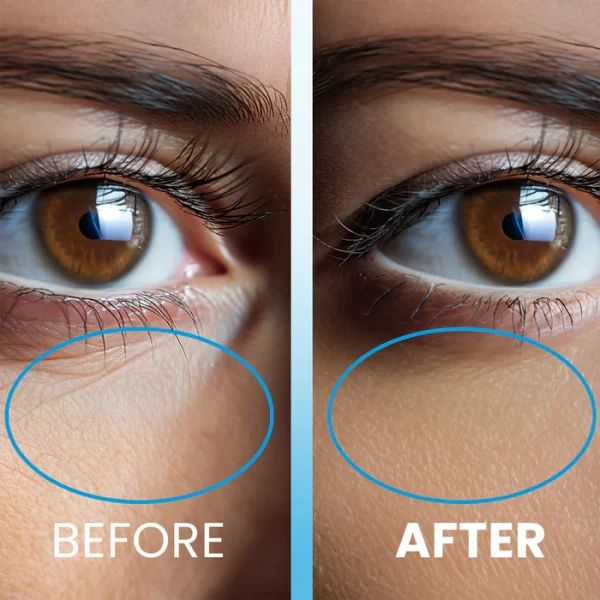 NEWWELL Ice Therapy Anti Wrinkle Shock Eye Serum 10 ml | نيوويل سيروم آيس ثيرابي المضاد للتجاعيد للعين ١٠ مل - الصورة 5