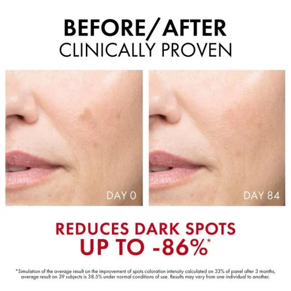 ⁦VICHY Lift Active B3 Serum Dark Spots & Wrinkles - 30ml | فيشي سيروم مضاد للبقع و التجاعيد - 30 مل⁩ - الصورة ⁦8⁩